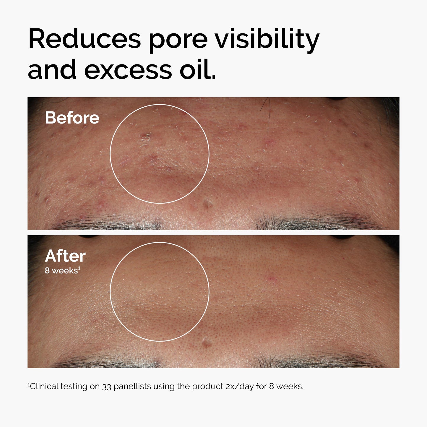 THE ORDINARY NIACINAMIDE 10% Zinc 1%
