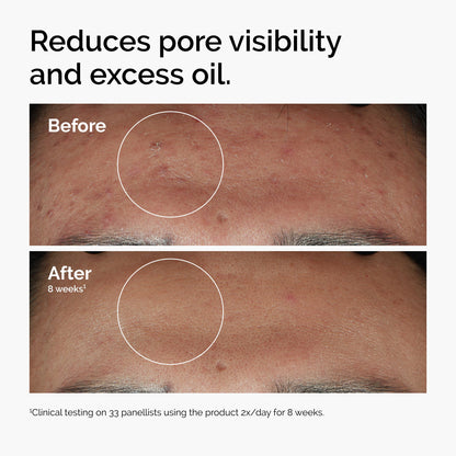 THE ORDINARY NIACINAMIDE 10% Zinc 1%